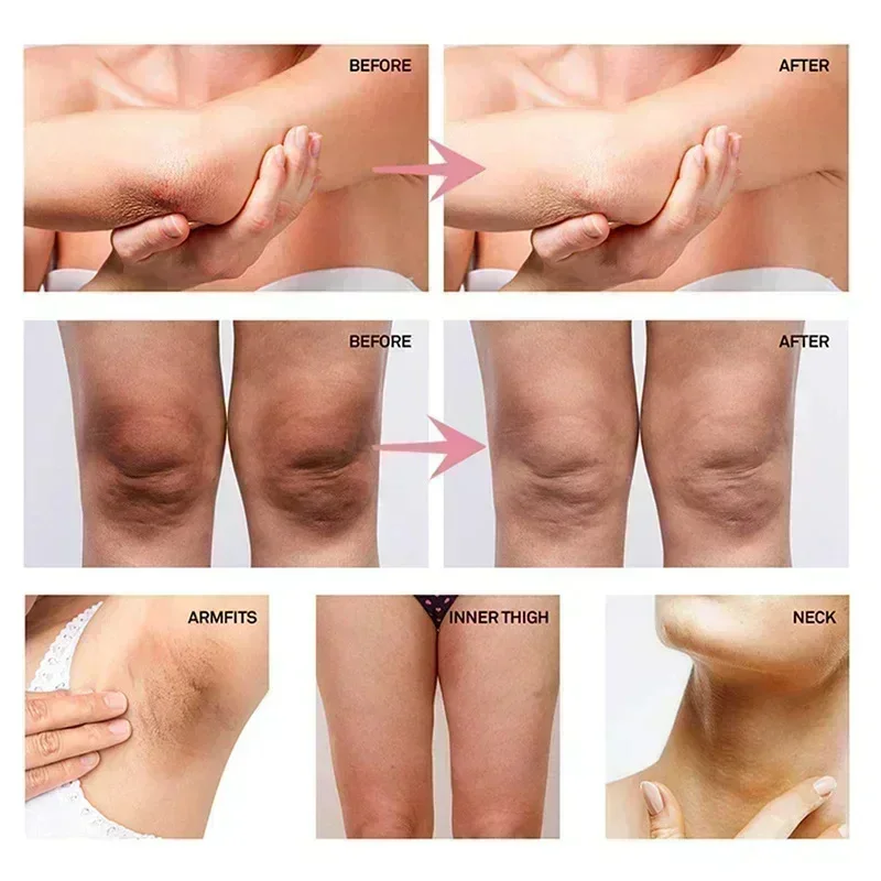 Collagen Underarm Whitening Cr - đánh giá và giá Anti-Aging Face Cream