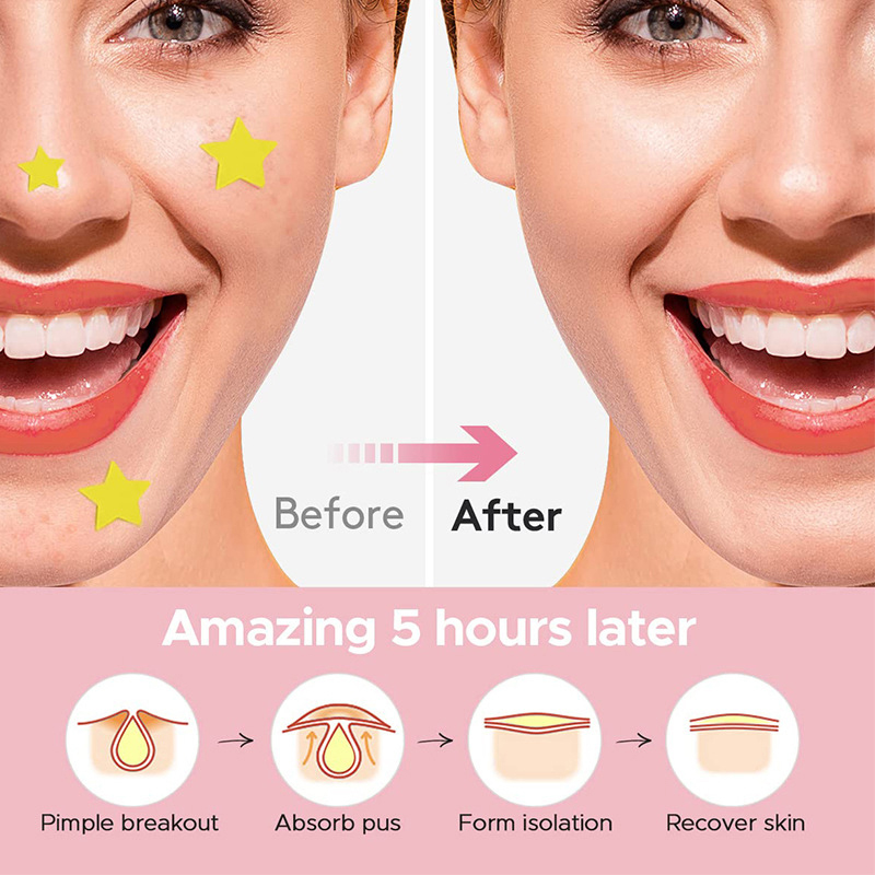 600Pcs/set Star Pimple Patch A - đánh giá và giá Beauty Makeup Remover