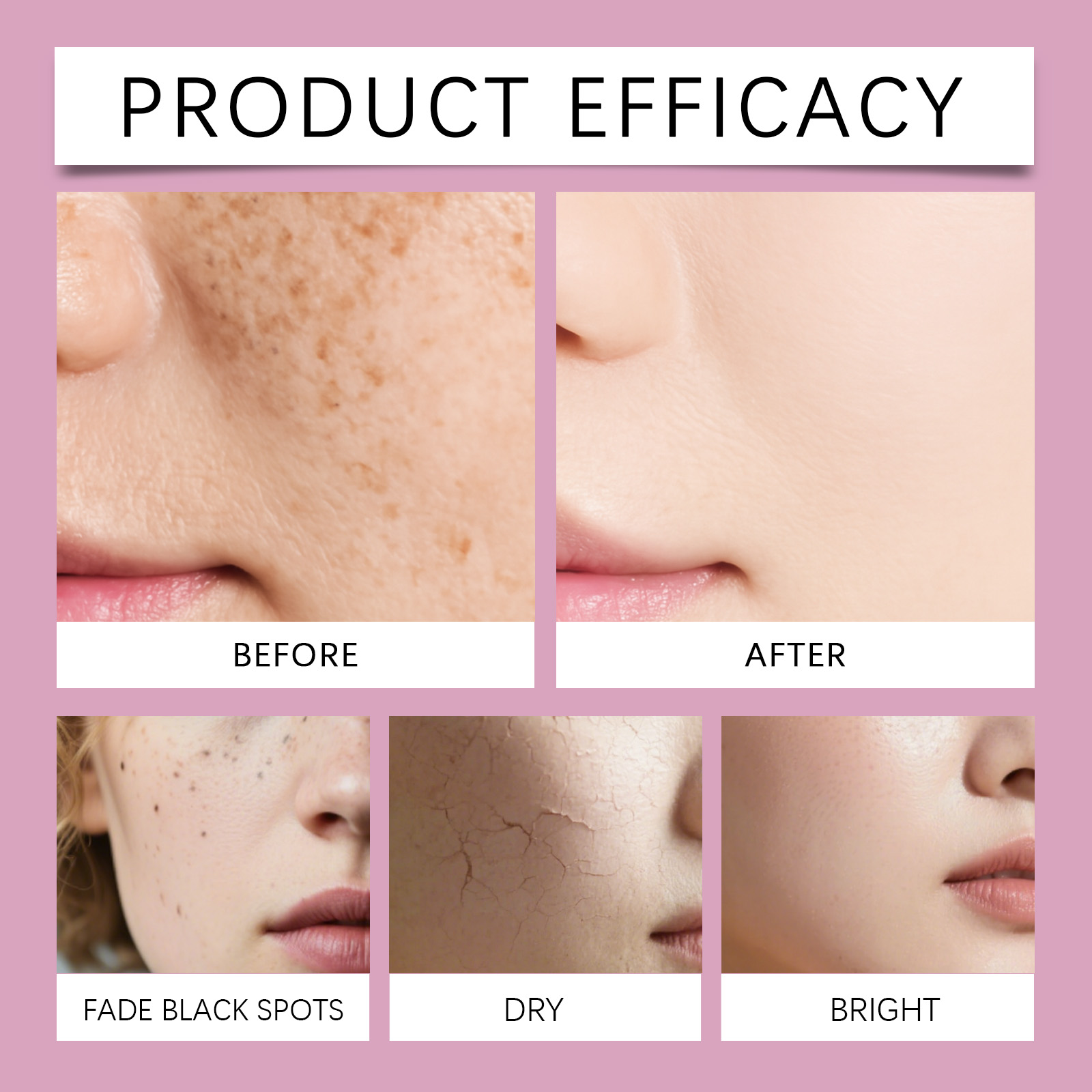 Korean Calcium Collagen Skinca - đánh giá và giá Anti-Aging Face Cream